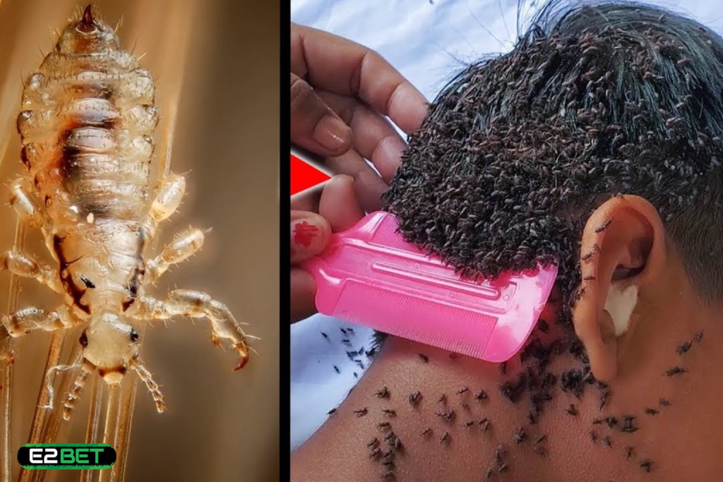 Nằm Mơ Thấy Bắt Chấy Đánh Con Gì? Bắt Lộc Ngay Từ Giấc Mơ!